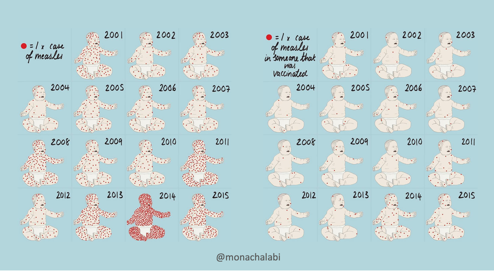 Monachalabi_measles