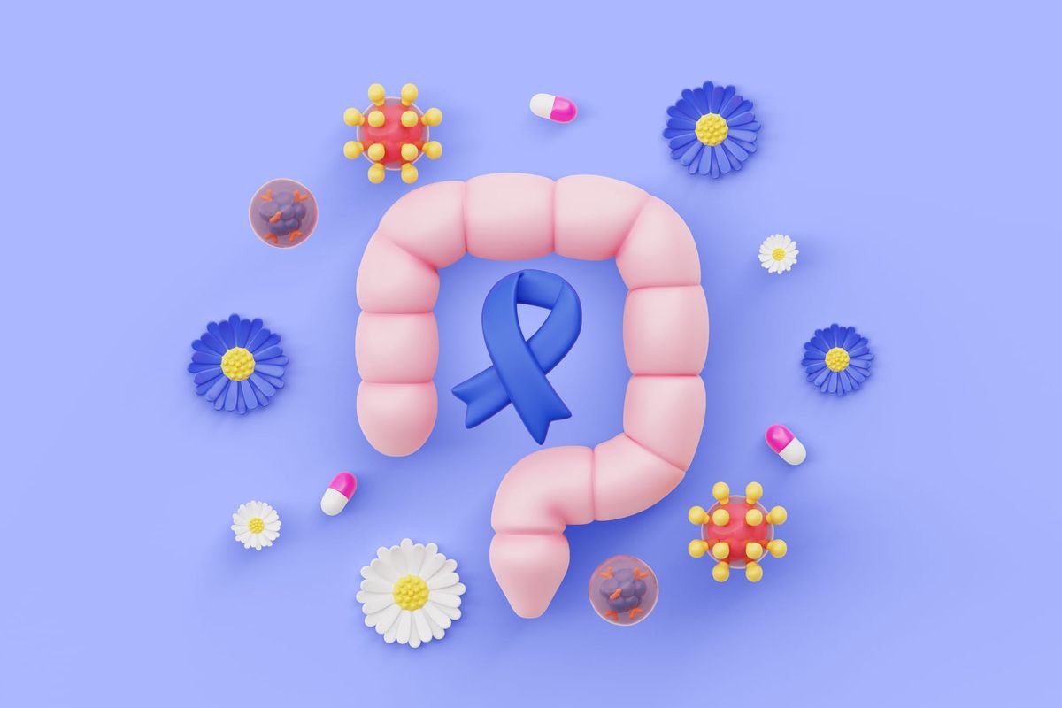 Préhabilitation avant chirurgie du cancer colorectal : exercice, nutrition et récupération