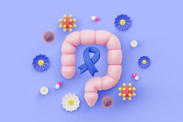 Préhabilitation avant chirurgie du cancer colorectal : exercice, nutrition et récupération