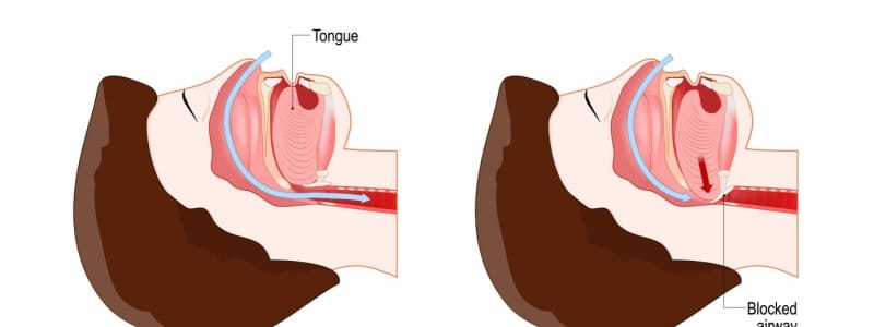 Sleep Apnea and Its Effect on Lung Function