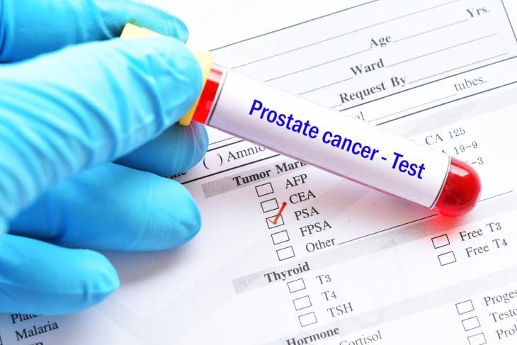 Blood Test Screening for Prostate Cancer