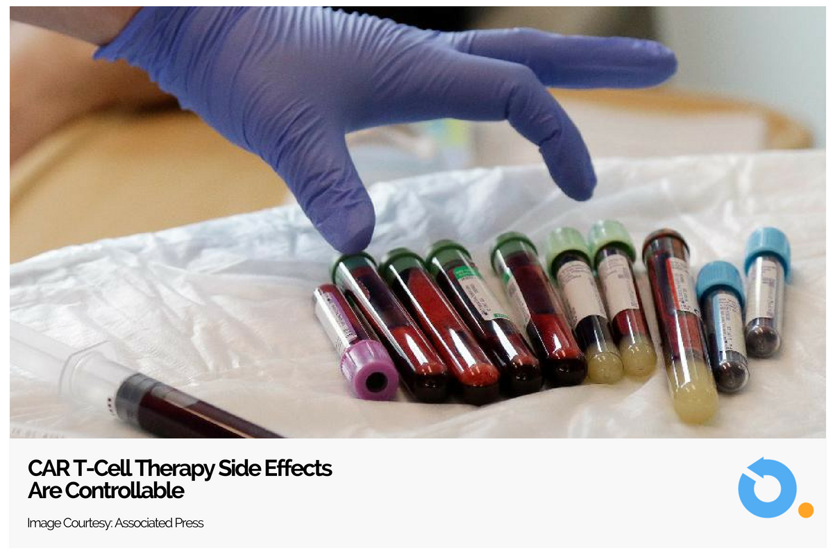 Possible to control the most common CAR T-cell therapy side effect, says new research