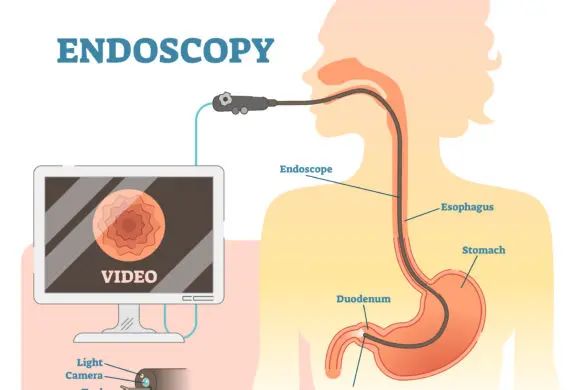 How are carcinoid tumours treated?