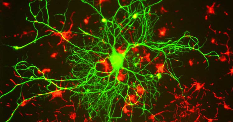 Cognition not Consciousness