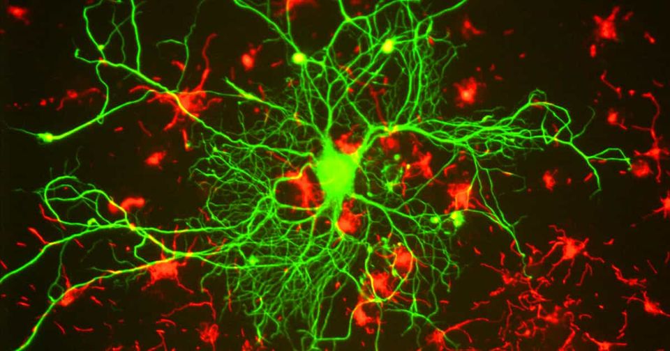 Cognition not Consciousness