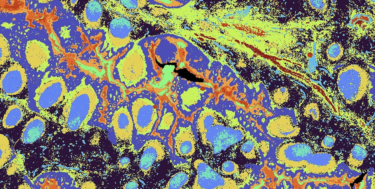 Bring tissue maps to life with Visium HD