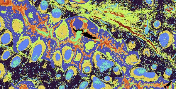 Bring tissue maps to life with Visium HD