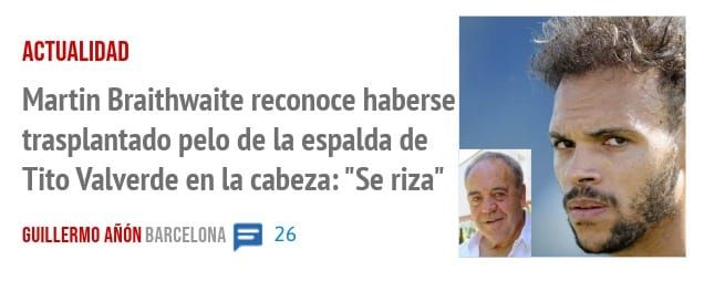 ACTUALIDAD. Martin Braithwaite reconoce haberse trasplantado pelo de la espalda de Tito Valverde en la cabeza: "Se riza"