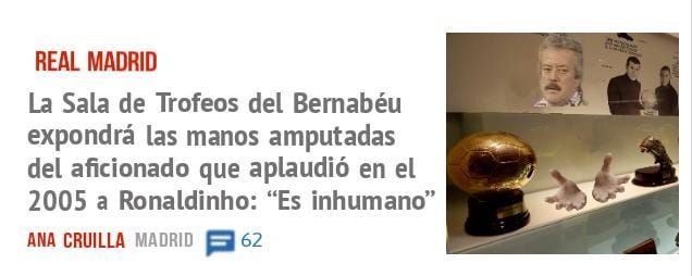 REAL MADRID. La Sala de Trofeos del Bemabéu expondrá las manos amputadas del aficionado que aplaudió en el 2005 a Ronaldinho: "Es inhumano"
