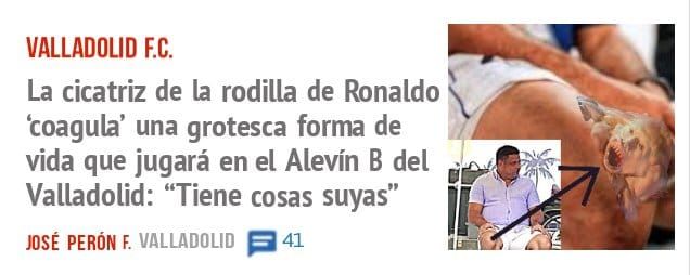 VALLADOLID F.C.. La cicatriz de la rodilla de Ronaldo 'coagula' una grotesca forma de vida que jugará en el Alevín B del Valladolid: "Tiene cosas suyas"