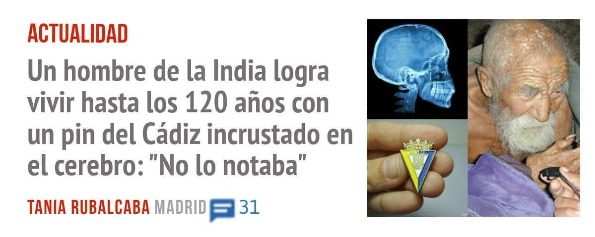 ACTUALIDAD. Un hombre de la India logra vivir hasta los 120 años con un pin del Cádiz incrustado en el cerebro: "No 10 notaba"