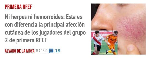PRIMERA RFEF. Ni herpes ni hemorroides: Esta es con diferencia la principal afección cutánea de los jugadores del grupo 2 de primera RFEF