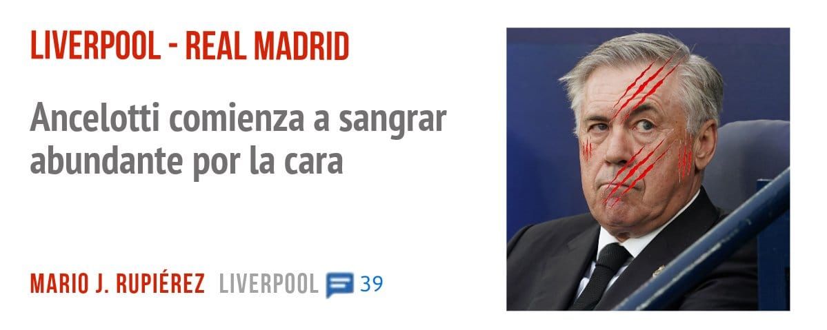 LIVERPOOL - REAL MADRID. Ancelotti comienza a sangrar abundante por la cara