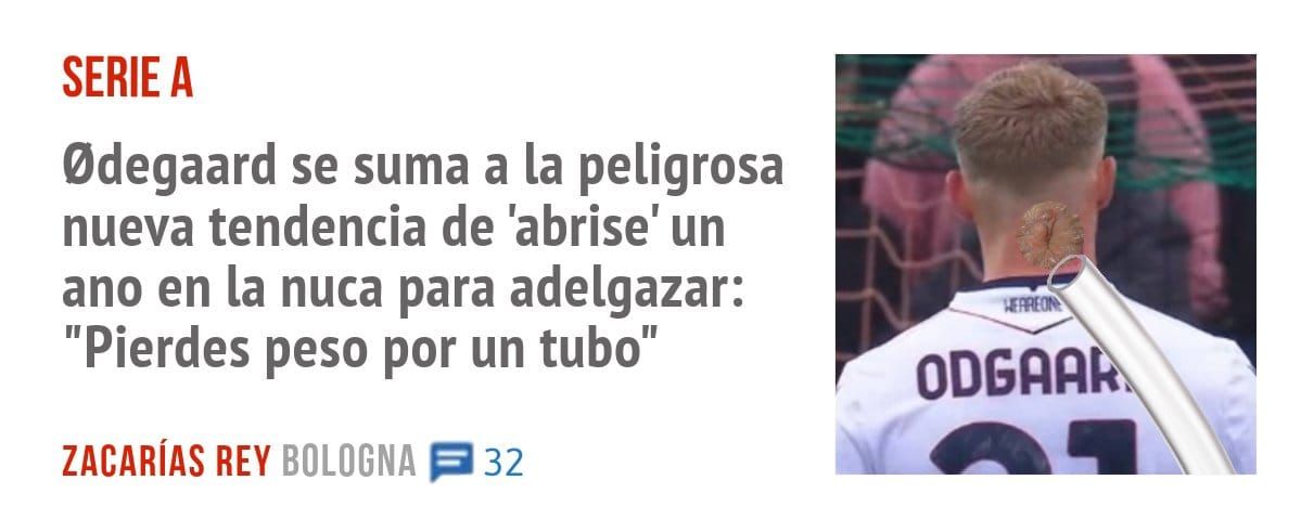 SERIE A. Odegaard se suma a la peligrosa nueva tendencia de 'abrise' un ano en la nuca para adelgazar: "Pierdes peso por un tubo"