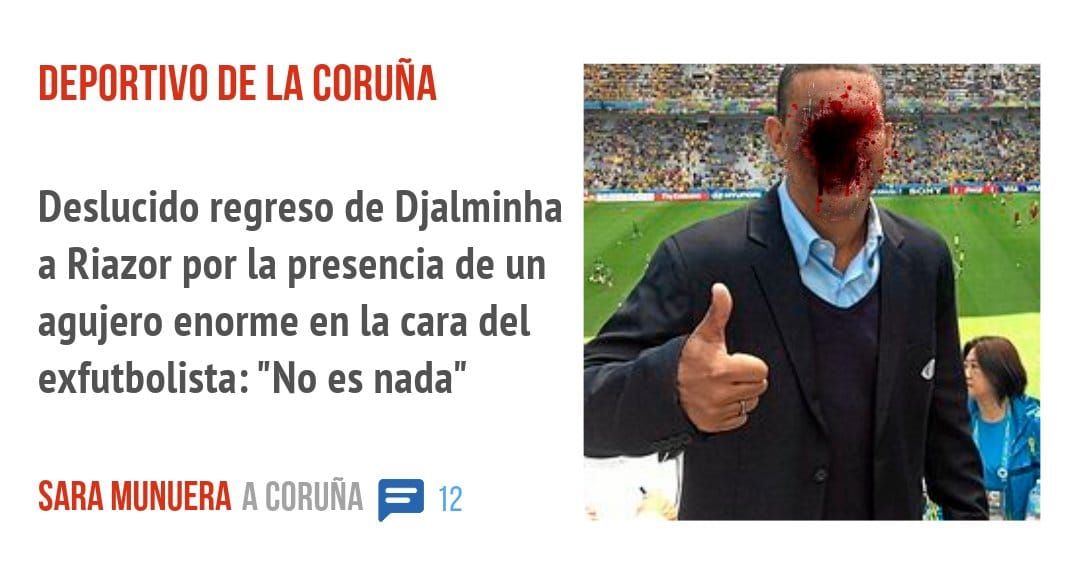 DEPORTIVO DE LA CORUÑA. Deslucido regreso de Djalminha a Riazor por la presencia de un agujero enorme en la cara del exfutbolista: "No es nada"