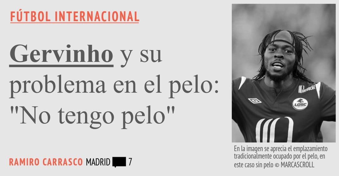FÚTBOL INTERNACIONAL. Gervinho y su problema en el pelo: "No tengo pelo"
