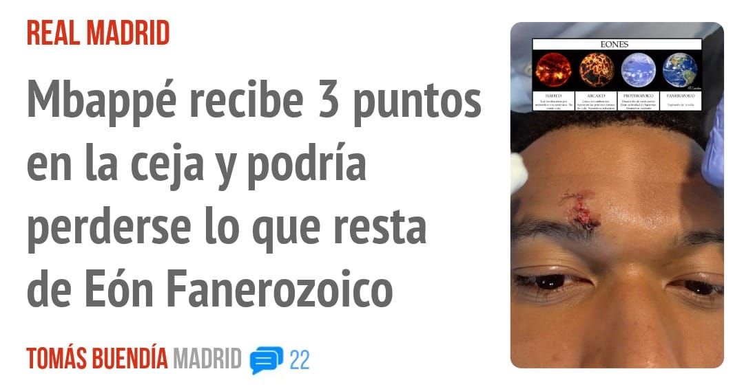 REAL MADRID. Mbappé recibe 3 puntos en la ceja y podría perderse 10 que resta de Eón Fanerozoico