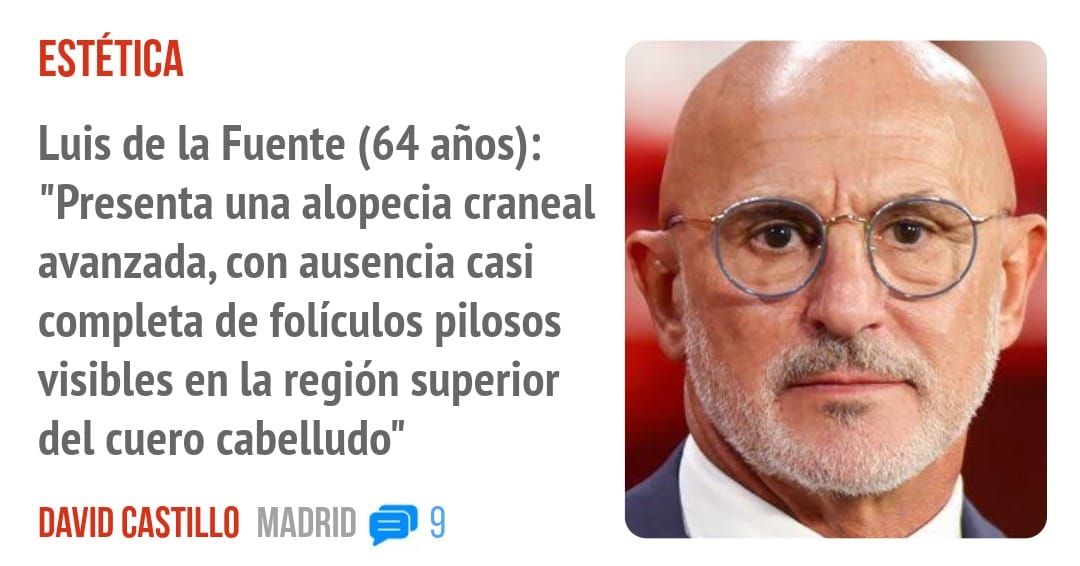 ESTÉTICA. Luis de la Fuente (64 años): "Presenta una alopecia craneal avanzada, con ausencia casi completa de folículos pilosos visibles en la región superior del cuero cabelludo"