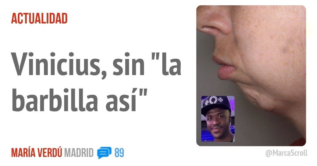 ACTUALIDAD. Vinicius, sin barbilla así"