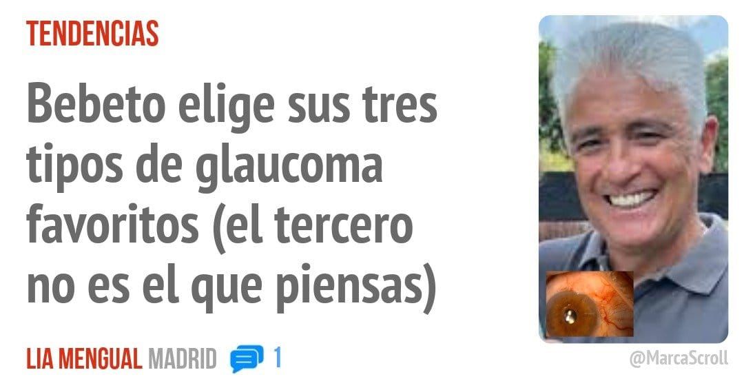 TENDENCIAS. Bebeto elige sus tres tipos de glaucoma favoritos (el tercero no es el que piensas)