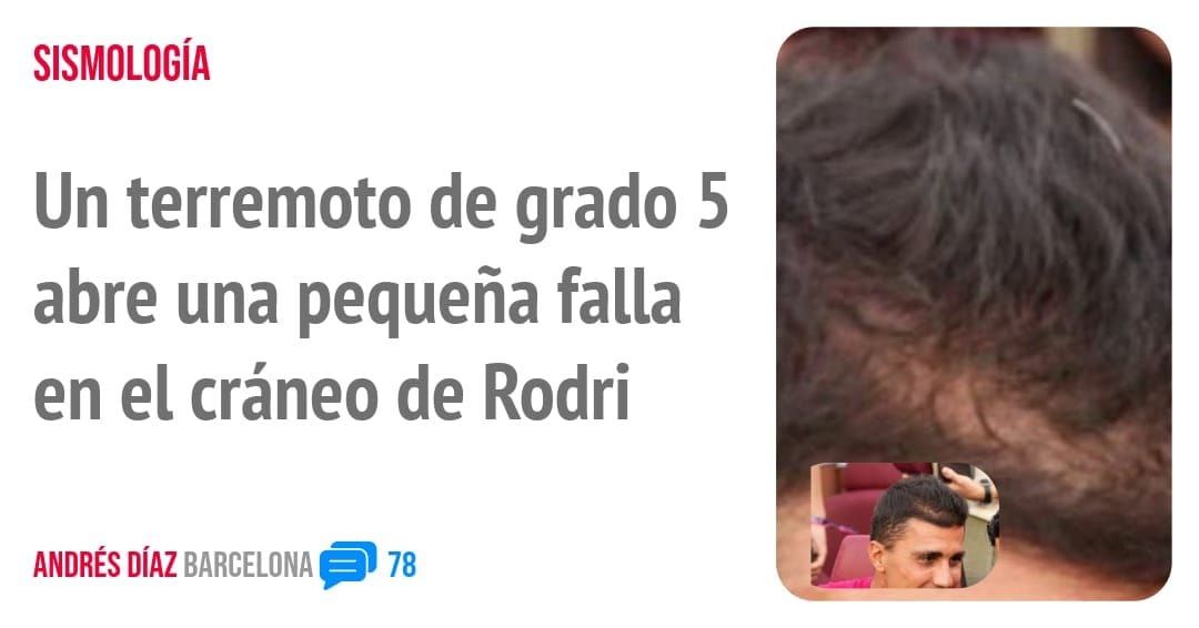 SISMOLOGÍA. Un terremoto de grado 5 abre una pequeña falla en el cráneo de Rodri