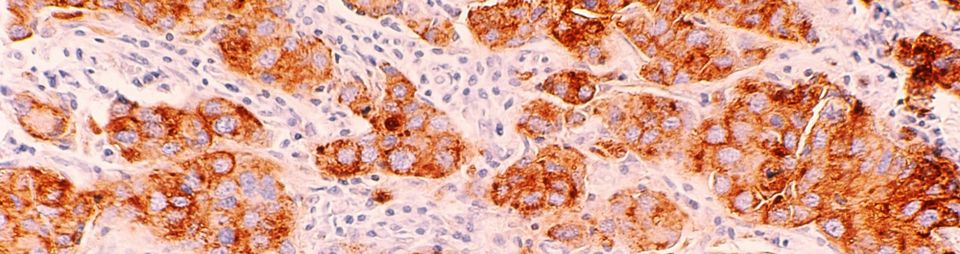 Level Up Your PD-L1 Skills!