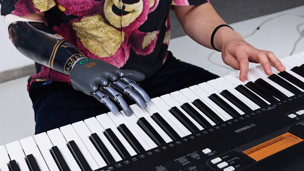 Live Performance Highlights Man’s Journey with Brain-Controlled Prosthetic