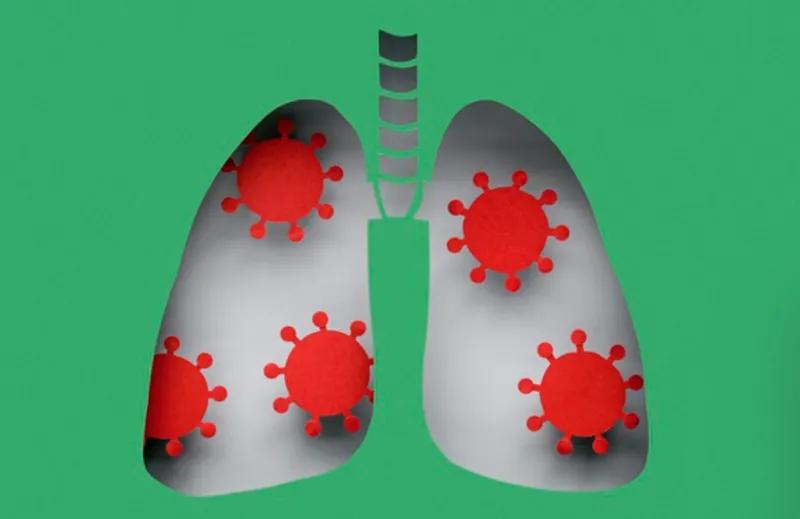 Paciente de trasplante murió tras recibir pulmones infectados con COVID-19