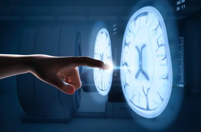 Hospital de Boston inicia ensayos de la primera vacuna contra el Alzheimer