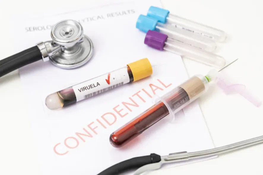 Paciente con viruela del mono tuvo contacto con 200 personas