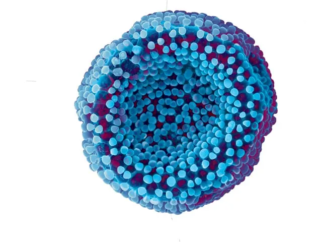 Micrografías de Microscopio Electrónico de Barrido (SEM) del Dr. Alan Harvey, colorización de la Dra. Wendy Deschene.