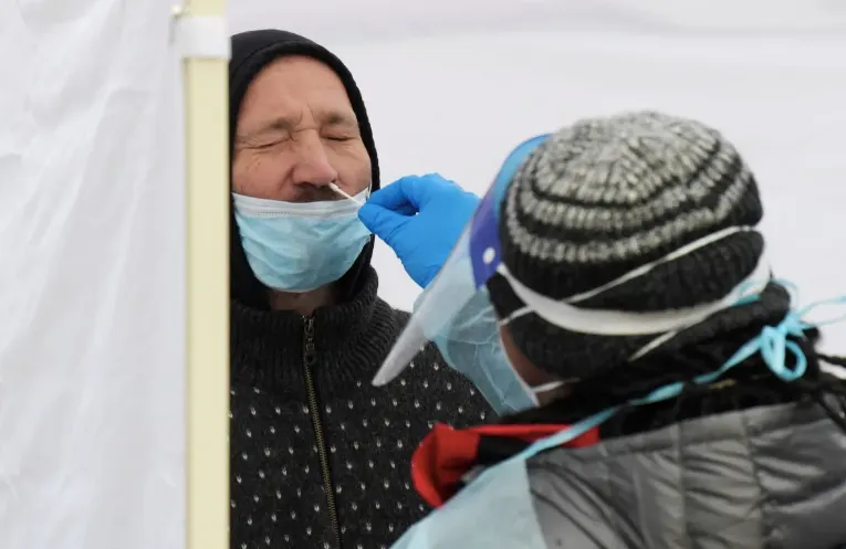 El long covid, también conocido como covid persistente o prolongado, ocurre en personas que tuvieron infección por coronaviru