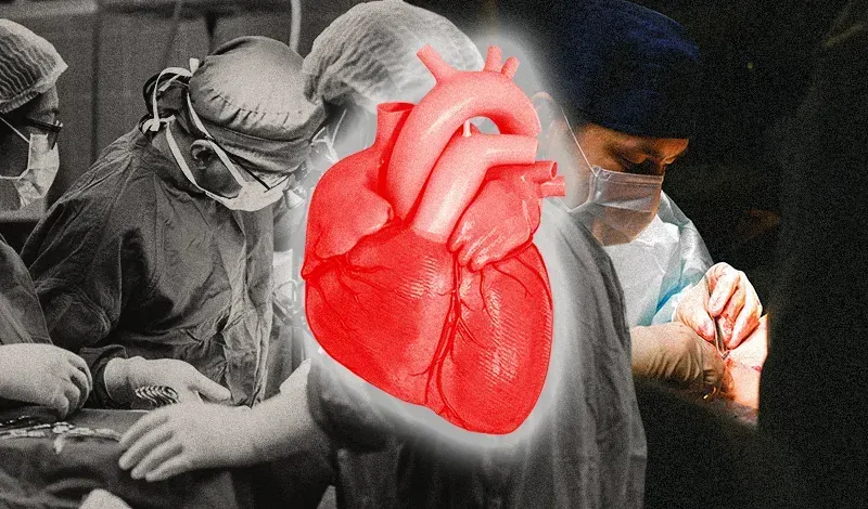 TRANSPLANTES. En 2022 se hicieron más de 42 mil trasplantes en Estados Unidos. | Foto: El Tiempo Latino.