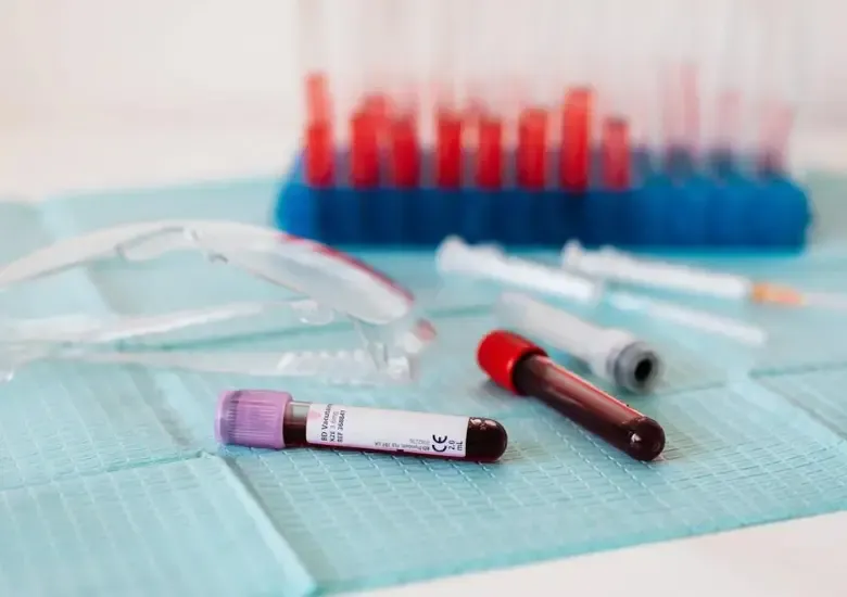 Nuevo análisis de sangre para detectar el Alzheimer tiene una precisión del 91%, según un estudio