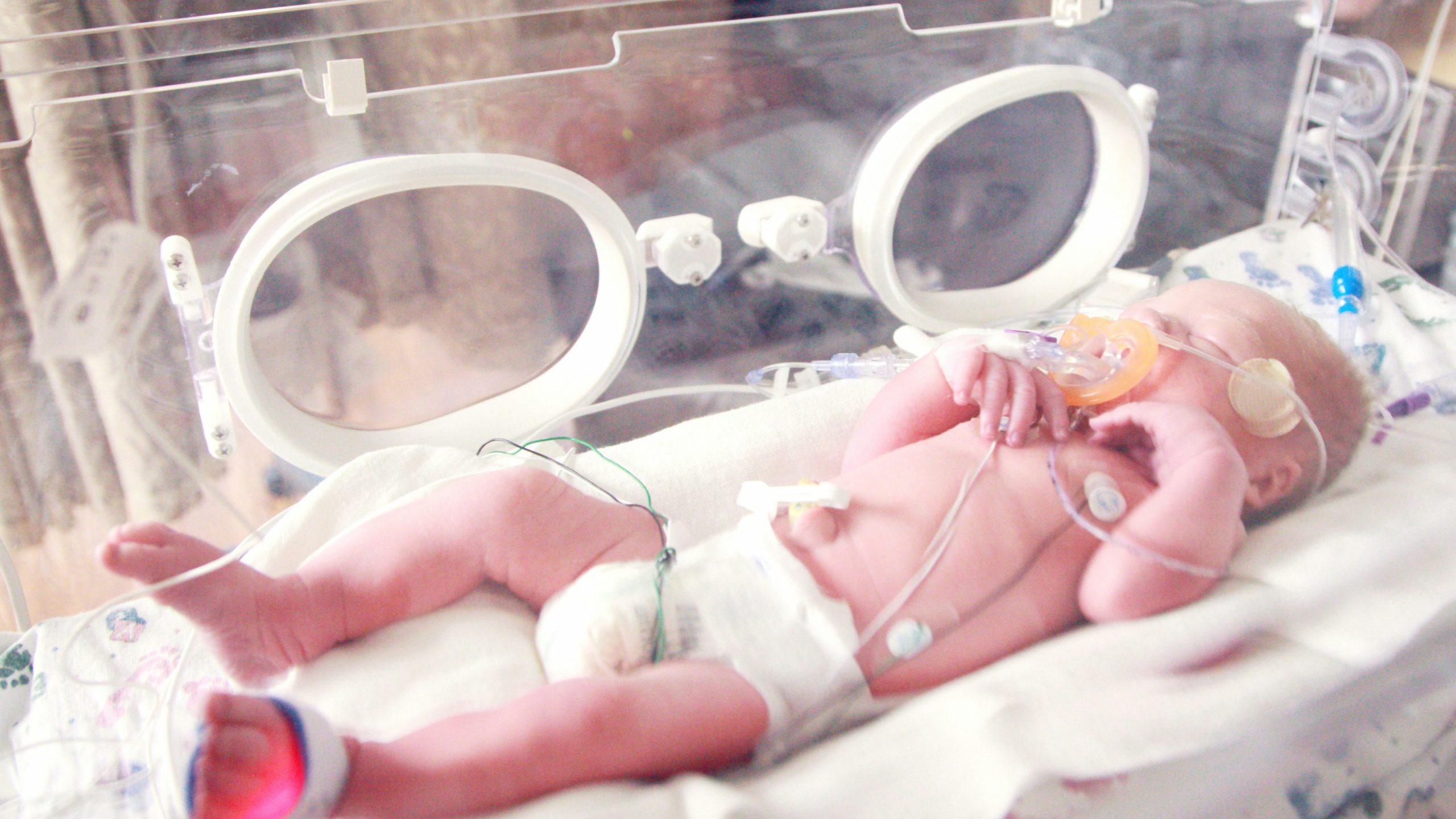 Delft Day Hospital Negligence Blamed for Newborn’s Death