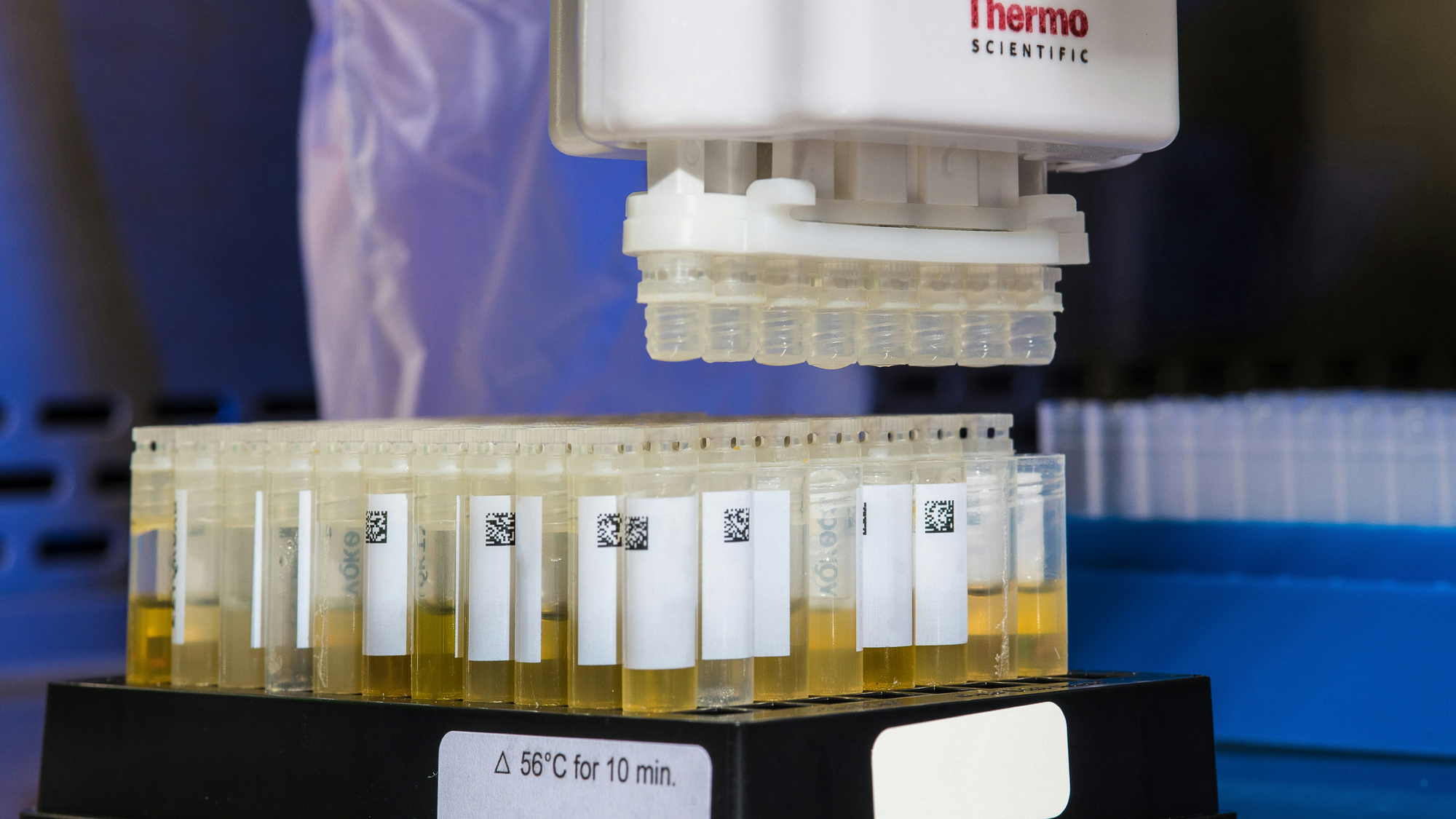 SA Hantavirus Response Praised as Risk Stays Contained
