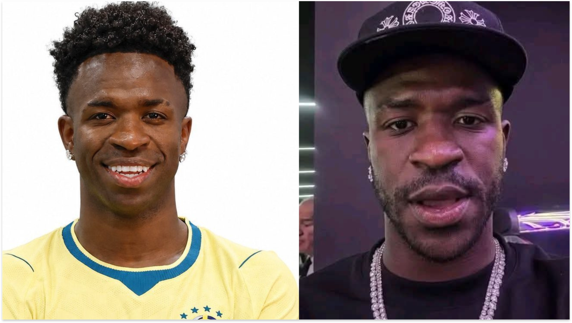 Vinícius Jr Cosmetic Procedure Draws Attention