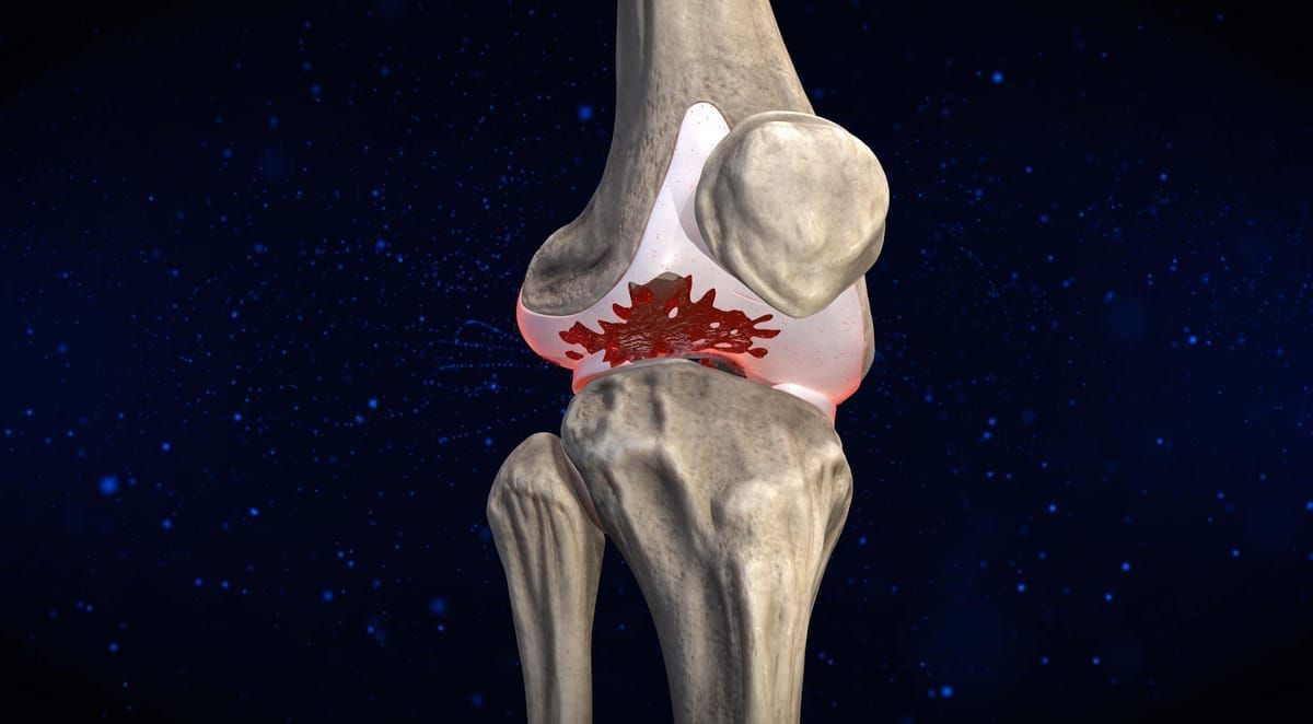 What If You Had Two Days to Back a Breakthrough That Could Change Lives and You Let It Pass?*