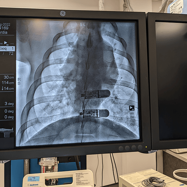 You Trusted a Stranger’s Netflix Password… But Not This?