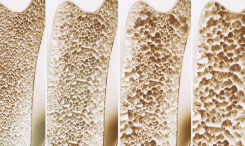Most People Rely on Calcium - Researchers Studied a Different Protein