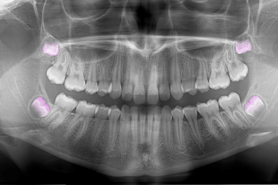 Amazon Is Making a Smartphone Again