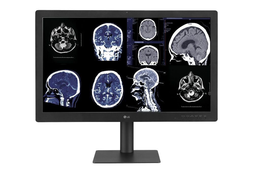 Advancing Medical Imaging: LG Launches 32HQ713D Diagnostic Monitor post image
