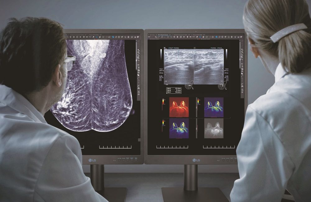 LG's New 5MP Monitor Targets Digital Mammography Market post image