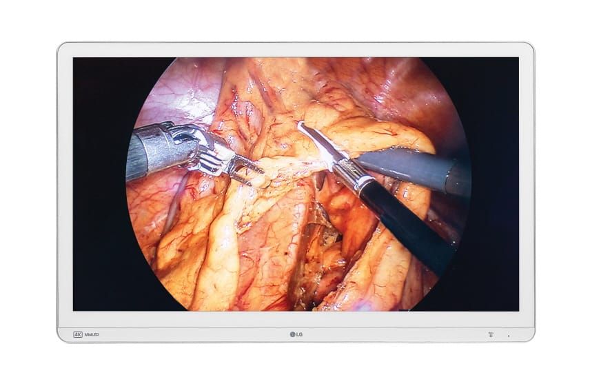 LG Electronics launches advanced surgical monitor with FDA clearance. post image