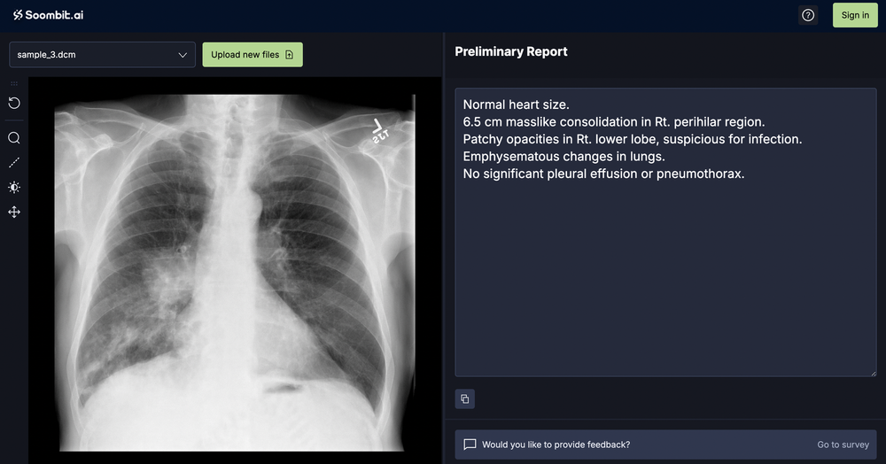 South Korean AI Medical Startup Soombit.AI Raises $3.6 Million Seed Round. post image