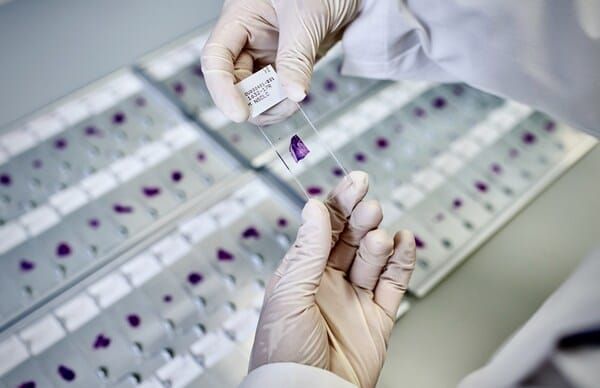 AstraZeneca, Lunit Partner on AI Cancer Mutation Detection Tool post image