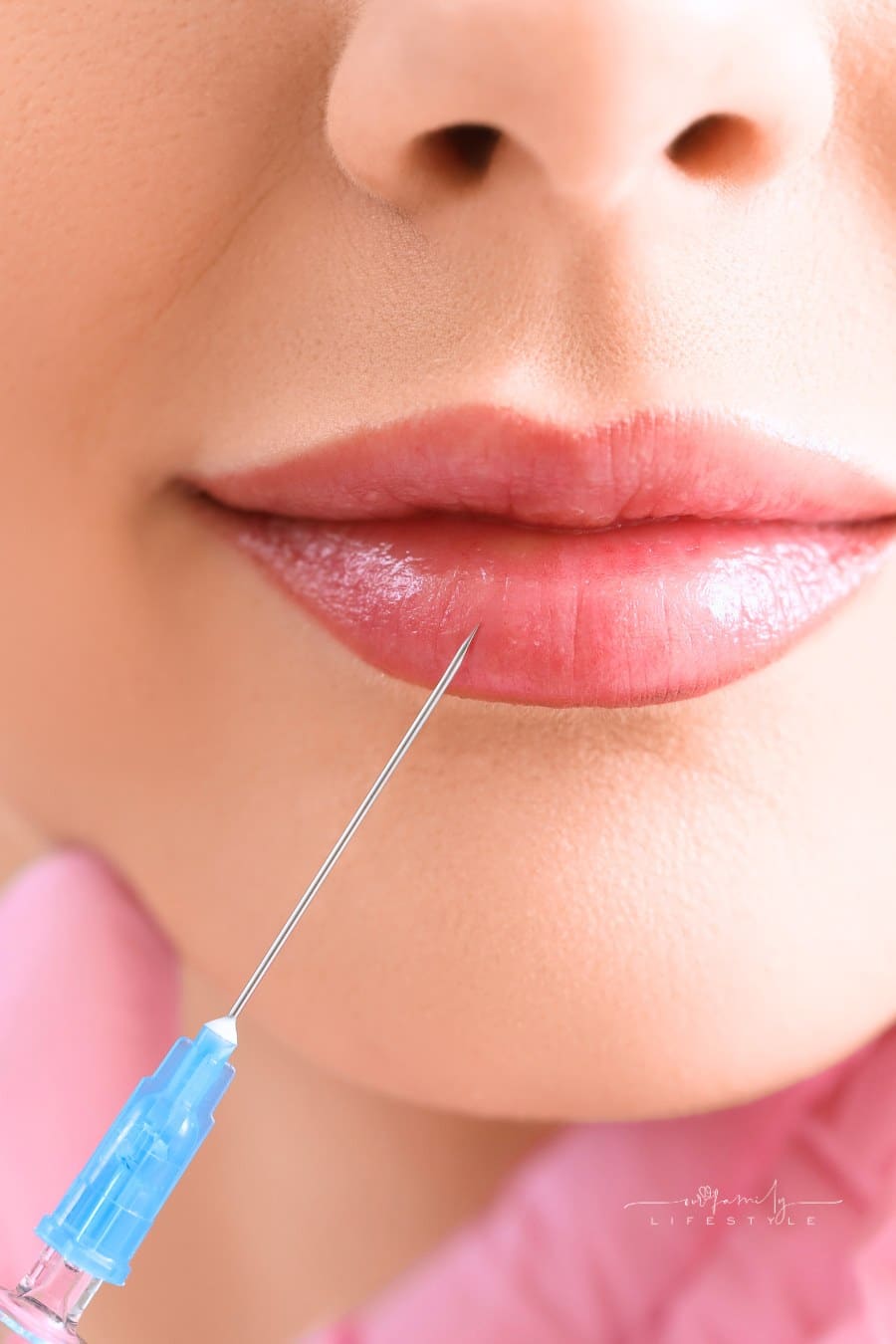 Young Girl Receiving Filler Injection in Lips, Closeup