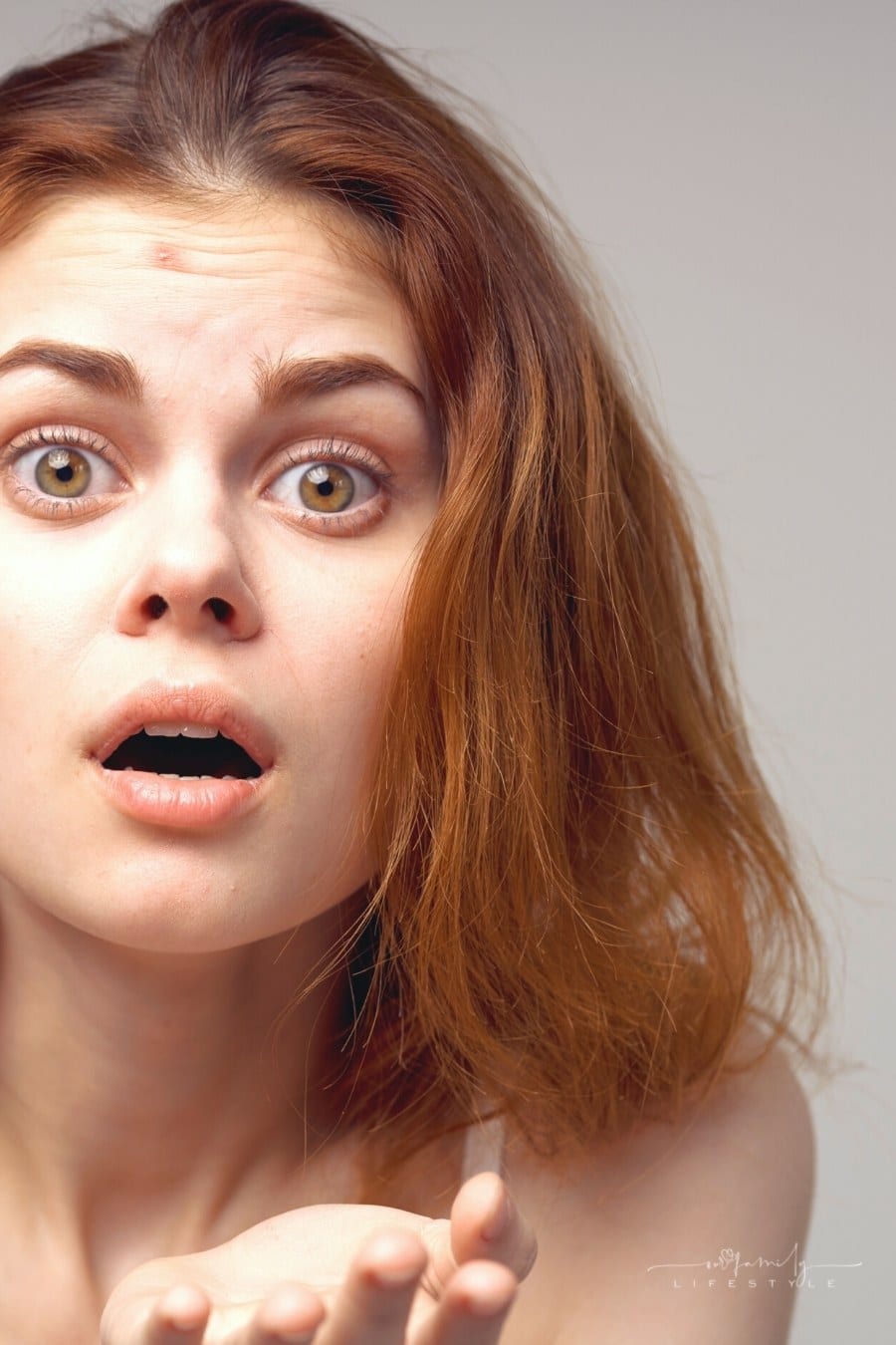teen upset over a pimple on her forehead