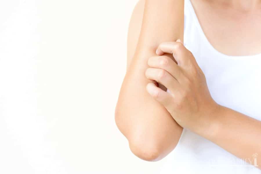itching arm rash due to fragrance allergy