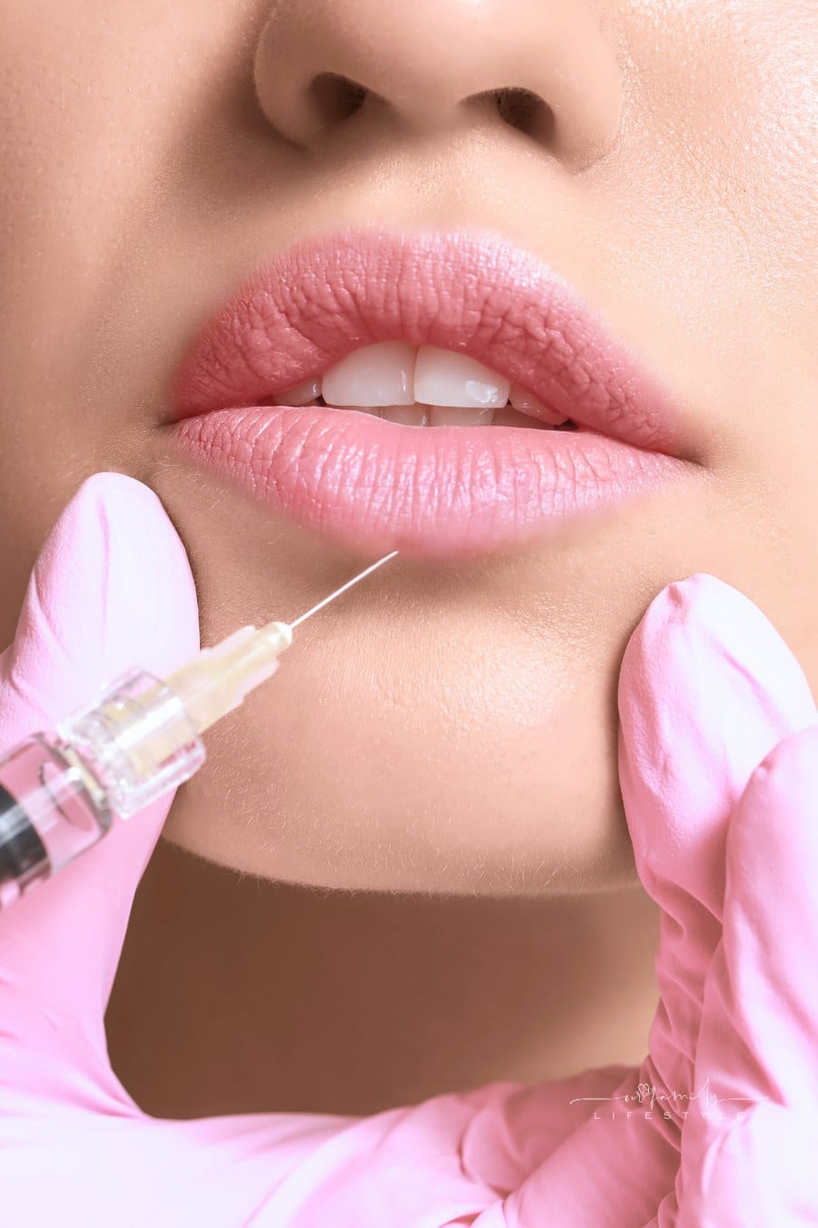 Young Woman Receiving Injection of Filler in Lips, Closeup
